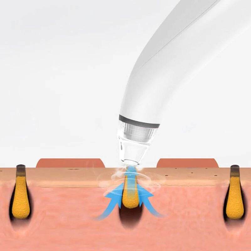 Electric Blackhead Remover Cleaner Face Diamond Pore Vacuum Suction White Heads - My Store