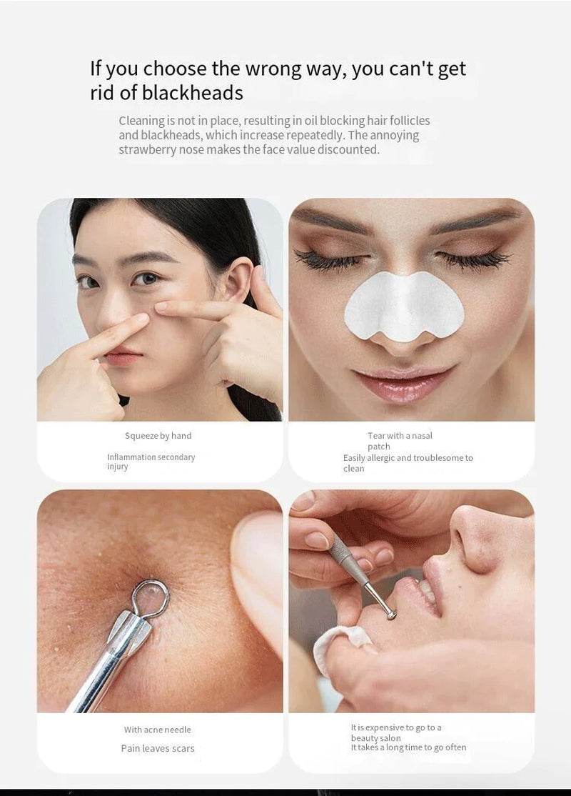 Electric Blackhead Remover Cleaner Face Diamond Pore Vacuum Suction White Heads - My Store