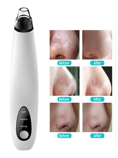 Electric Blackhead Remover Cleaner Face Diamond Pore Vacuum Suction White Heads - My Store